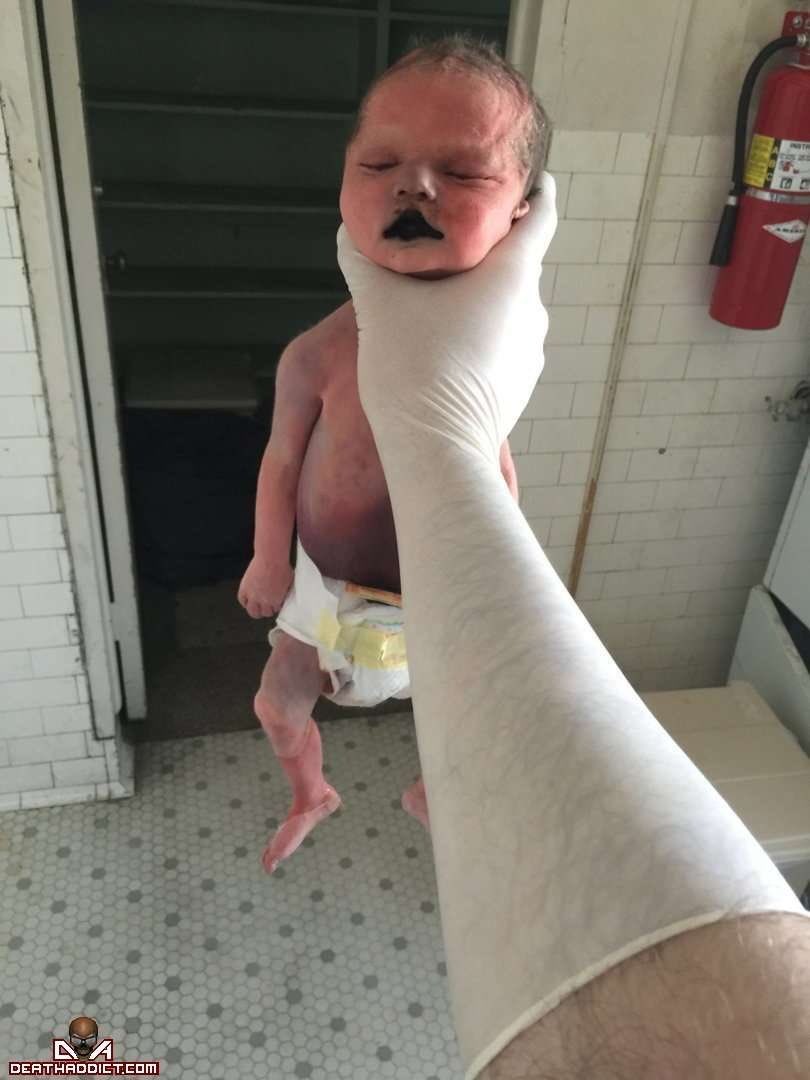 Sigurd 🐸 tweet media