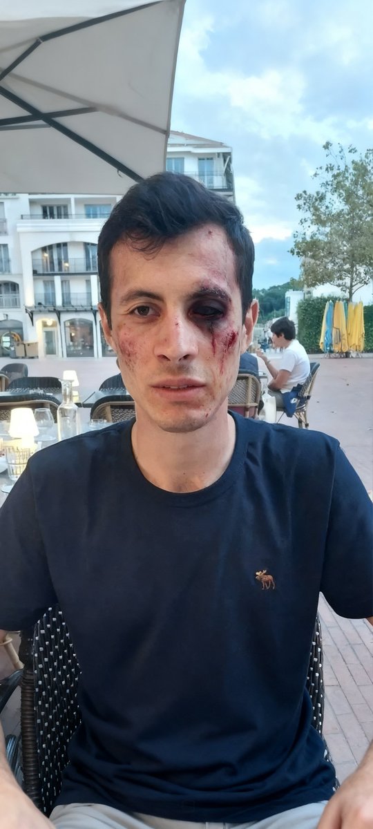LukanaR69 tweet media