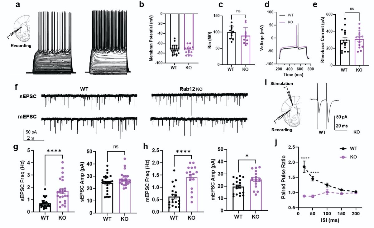 ScienceofPD's tweet image. Live-cell imaging of cultured cortical neurons reveals that LRRK2 substrate Rab12 deletion facilitated, while Rab12 overexpression inhibited, synaptic vesicle exocytosis; A physiological role for RAB12 in synaptic function - implications for #Parkinsons?
nature.com/articles/s4153…
