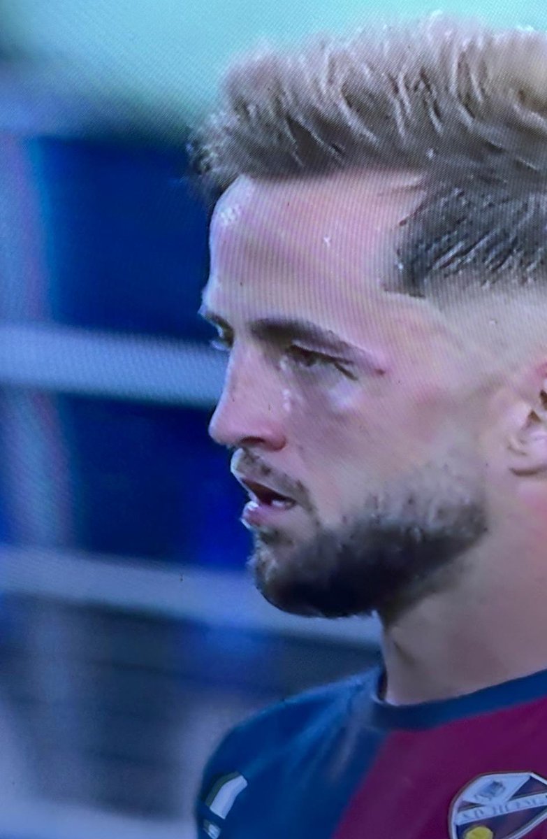 Pausismo tweet media