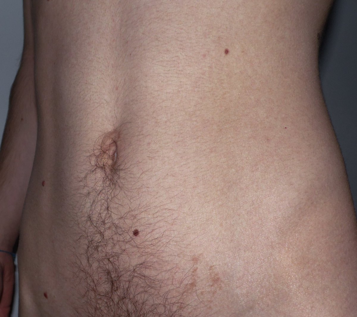 simon 🪽 tweet media