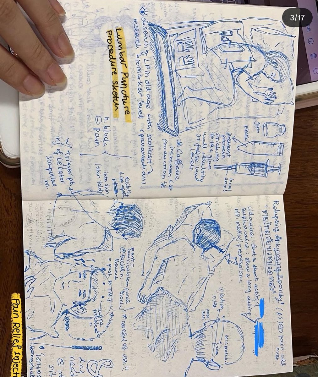 PJaseja's tweet image. Came across these damnnn cool ways of making Neurology notes 
So amazing!!
#Medtwitter

Credits-instagram.com/hana.learnen