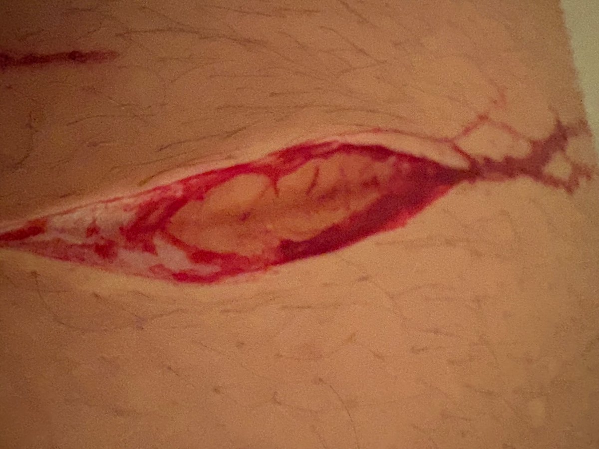 Lime Girl of SHEDTWT =^.^= tweet media