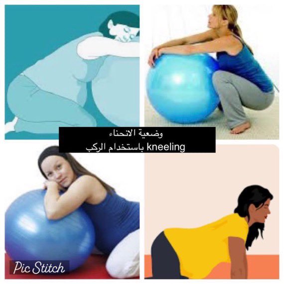 Dr_mahaalnemer's tweet photo. لايوجد حوض ضيق"

✅خلق الله الحوض وله قابلية التوسع بسبب هرمون الريلاكسين وإرخاؤه اربطة الحوض
ولذا ترى أن طريقة مشي الحامل تتغير 
✅وخلق الله رأس الجنين فيه فراغات بين عظام الجمجمه؛تتداخل مع بعضها وتغّيّر شكل الرأس حتى يدخل في المهبل

✅ثلاث تمارين في التاسع واثناء المخاض تفتح الحوض أكثر وتساعد على نزول الجنين:

١-حركة دائرية على الكرة أو سكوات عميق: يفتح مدخل الحوض

٢-اندفاع امامي:يفتح منتصف الحوض

٣-انحناء باستخدام الركب kneeling : يفتح مخرج الحوض 

✅وكلها تساعد على دخول الجنين للحوض وتقليل تعسر الولادة

🔴و أفضل أختبار لمقاس الحوض وحجم الجنين هو الولادة نفسها 
#ثقافتك_تحميك