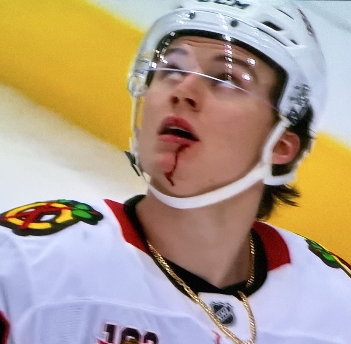 the vancouver youth of the nhl