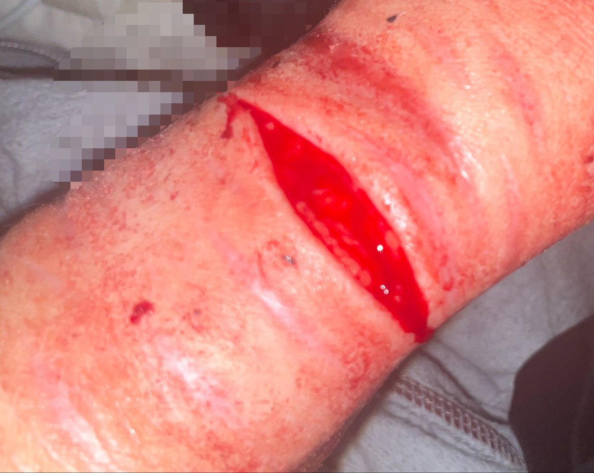 Dove † • Vittorino of shedtwt • † tweet media