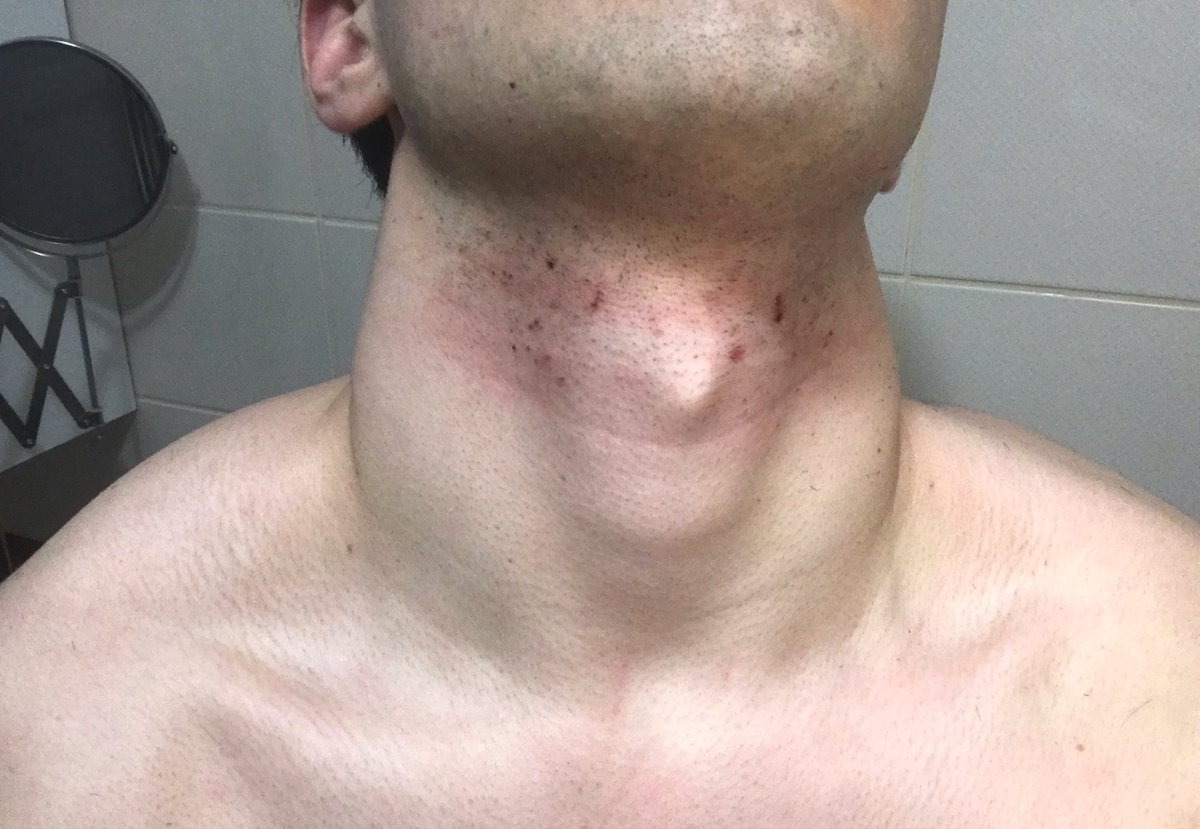 amaneyse tweet media