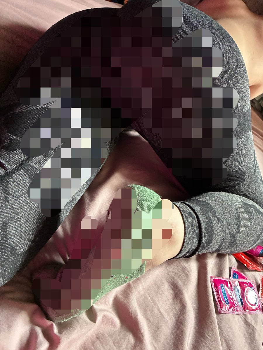 stinkysugartoes's tweet photo. end pic is my favouriteโฆ honestly iโd pay to see it ๐ฅฑ๐who needs a gassy girl??!
silent but deadly
#fart #fartfetish #feetfetish #gassy #gassygirl #paypig #foot #bdsm #feetworship #prettyfeet #soles #nails #feetdomination #toes #feetlovers #smellyfeet #smellyfart #stinkyfart https://t.co/5OcxzE6kM9
