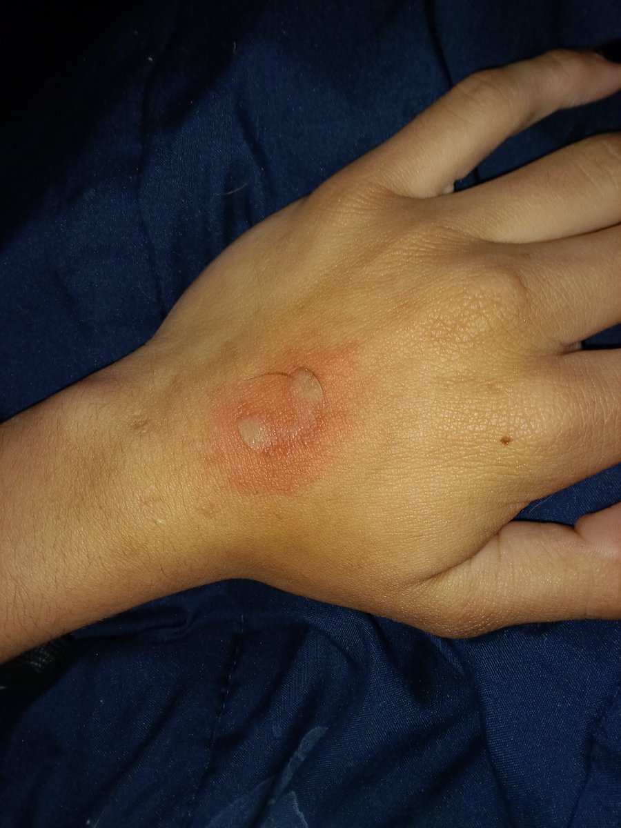 🦌wren |shtwt| 🦌 tweet media