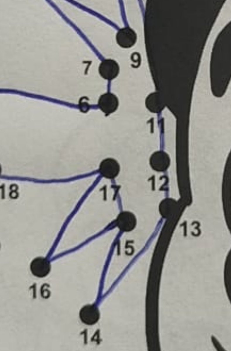 Grendaaaa's tweet photo. @peinemorado8 Y esta confusión si que es para estar tieso tieso uuuh 💀 https://t.co/H2h16aAANZ