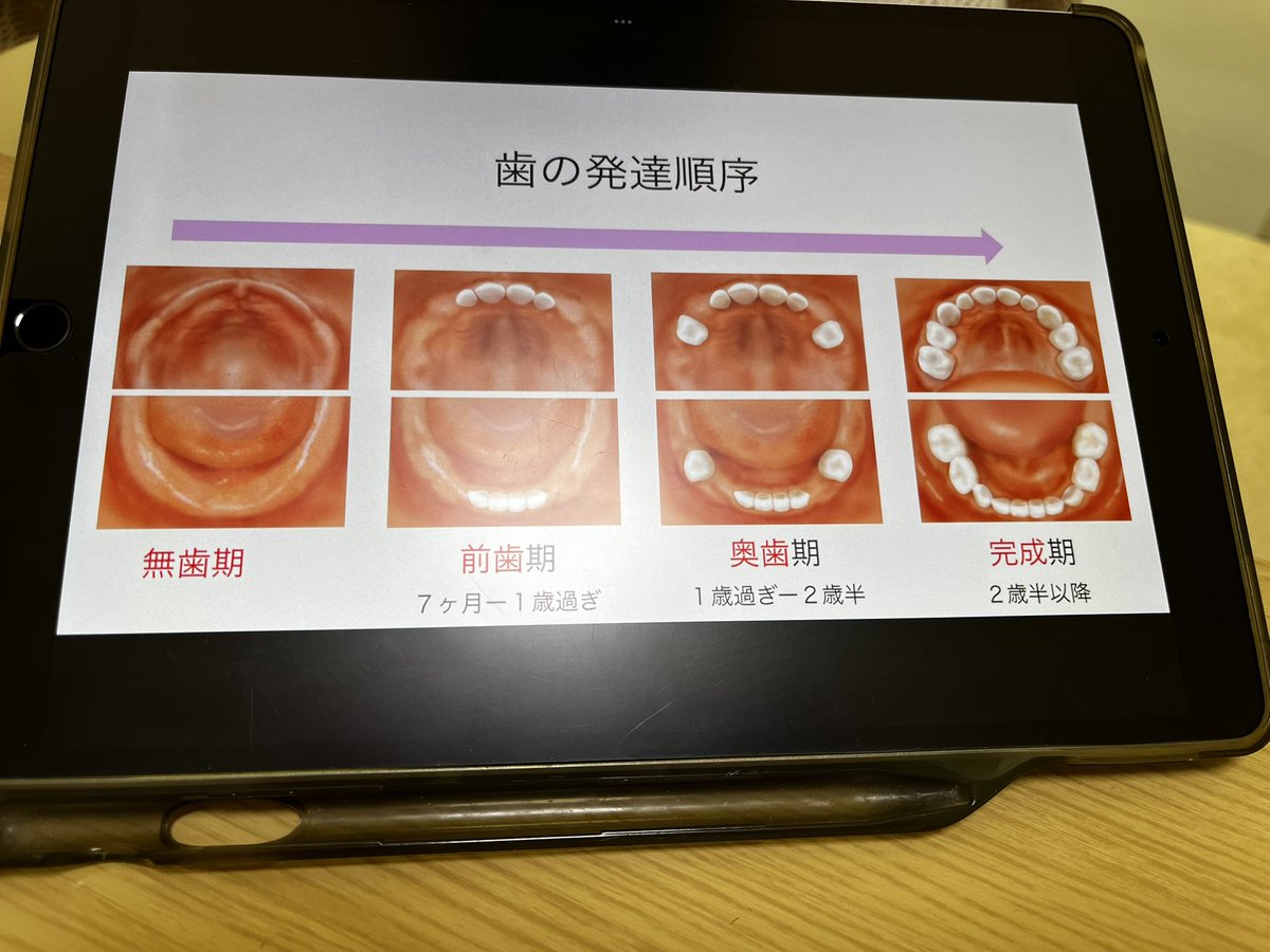 小児歯科の栄養士さん曰く、
歯の本数が右から二つ目の写真の状態になってから幼児食を始めたほうがいいらしい！
それまでは保育園に幼児食を勧められても、離乳食のままのほうがいいみたい