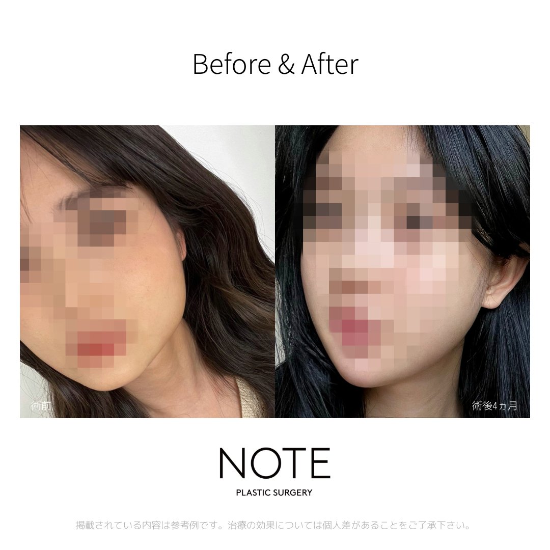 韓国ノート美容外科 tweet media