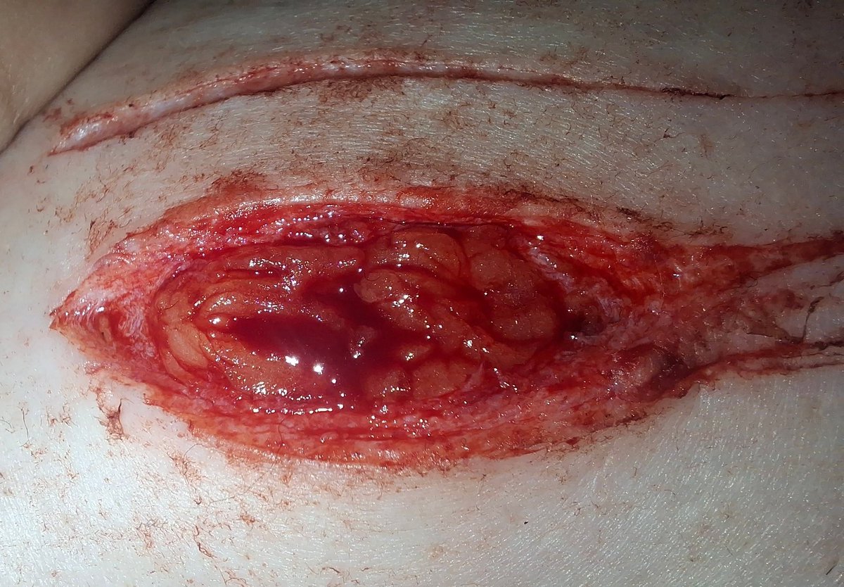 wıłl ɓyɛrṣ ⋆˚꩜.ᐟ øf·shtwt tweet media