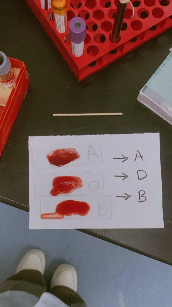 nora1411m's tweet image. #laboratory #blood_bank #مختبرات_طبيه #مختبر 

ايش الفصيله ؟؟