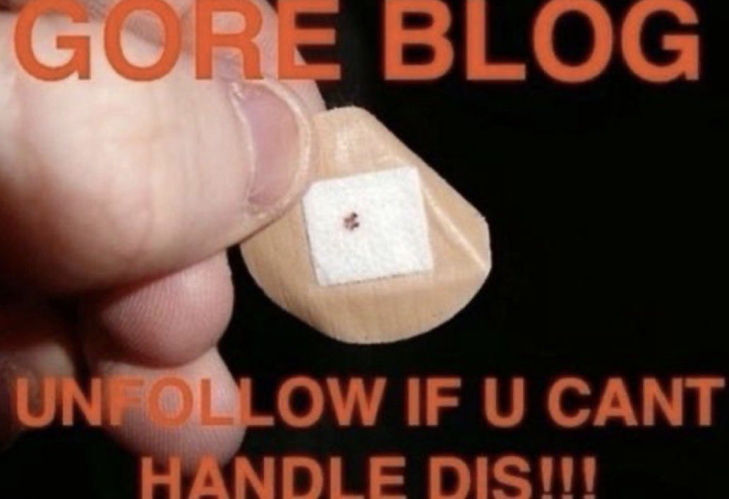 dogturdz69_'s tweet image. lil ol scratcs 

#shtwt #shed #moothunt〃・