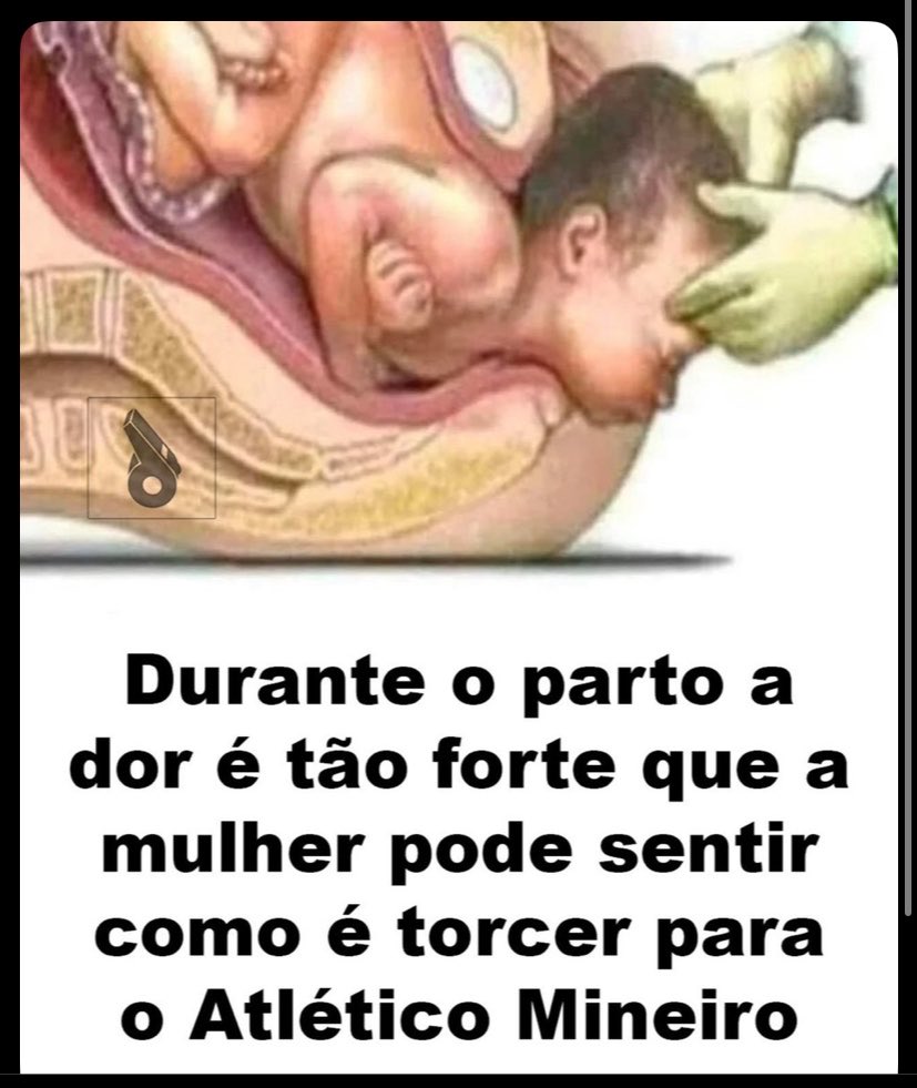 GALONIZADO tweet media