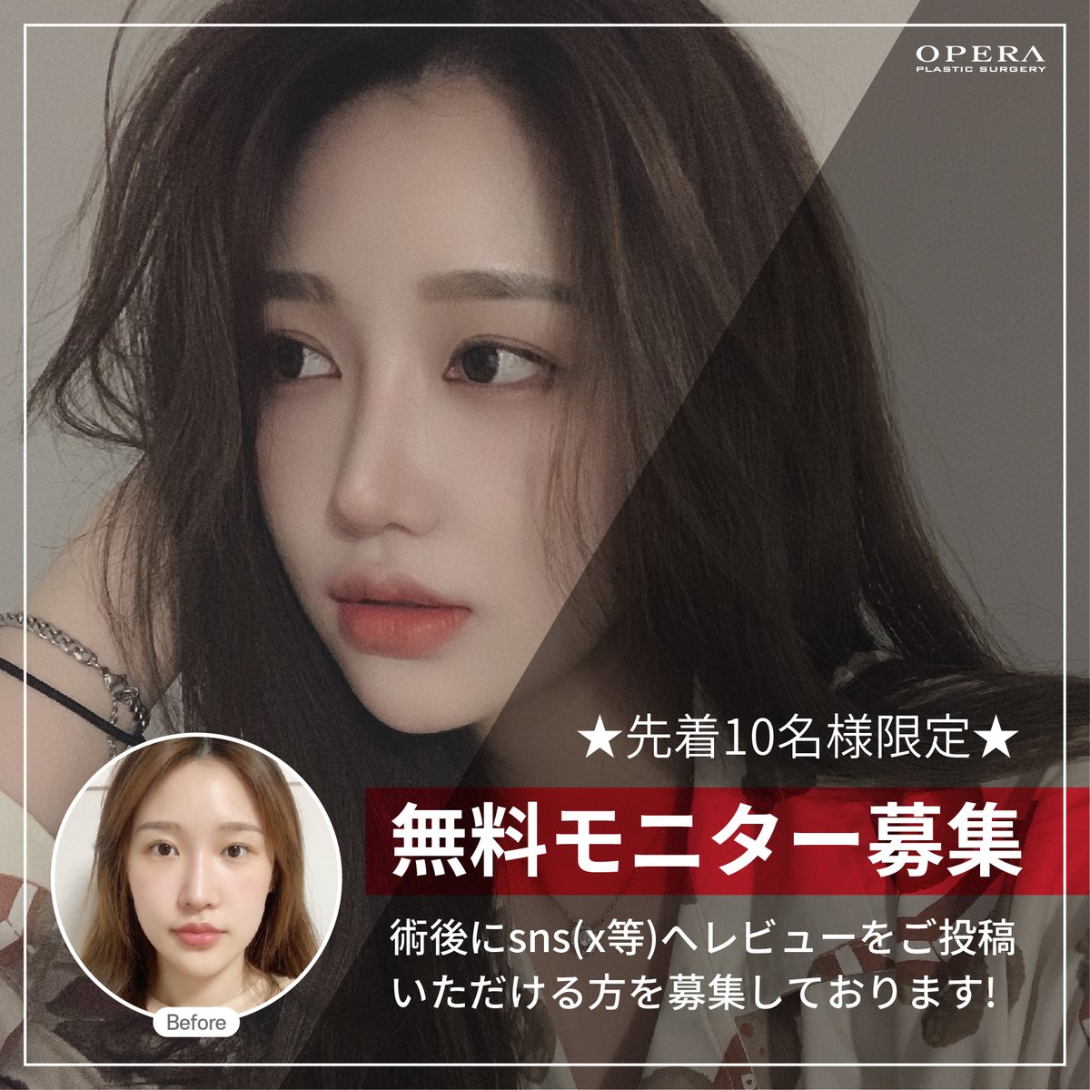 オペラ整形外科【公式】 tweet media
