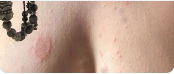 Dayear Leo tweet media