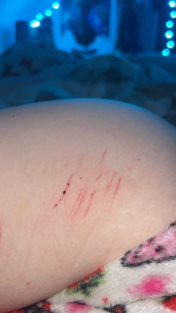 obxxsessed's tweet photo. cat scratches 4 life https://t.co/NzyBPZwWY7
