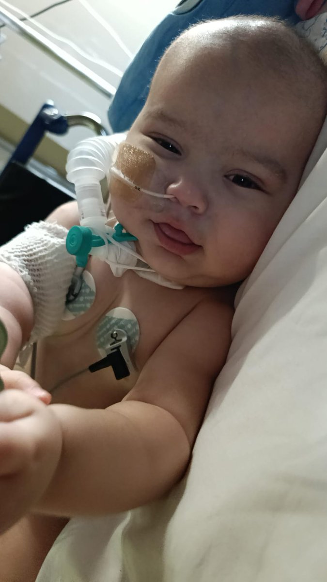 AnyColazo's tweet photo. Actualizamos Todos por Gio entonces! Gio tiene un año y está en el Garrahan esperando para volver a casa, necesita Respirador, oxímetro, humificador, nos ayudas si 27340 personas donan 100$ o 2734 donan $1000 Gio se va a casa! alias https://t.co/VxqbWnVVnm nos ayudas ? RT https://t.co/c2VhVO7MpY