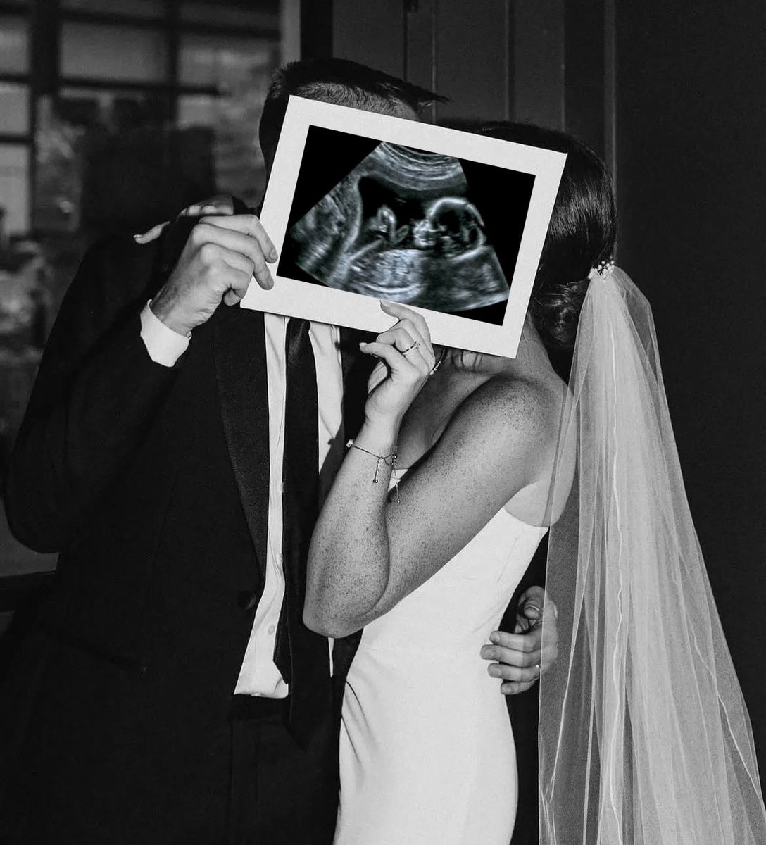 mills💍🤰🏻 | SE CASOU tweet media