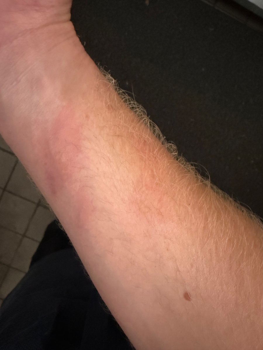 When you're genuinely having a bad day and spill oil on your arm