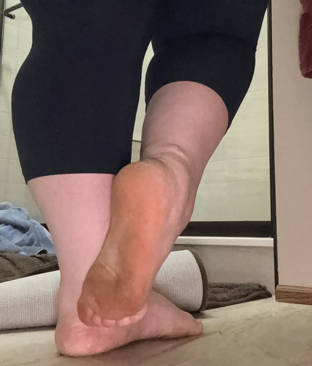 ScarredSwollenFooties 🦶 tweet media