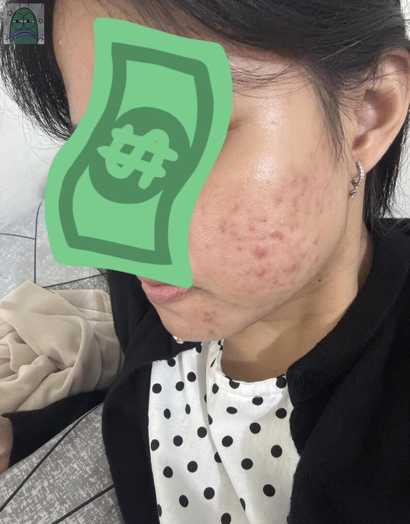 Tanyarlfes tweet media