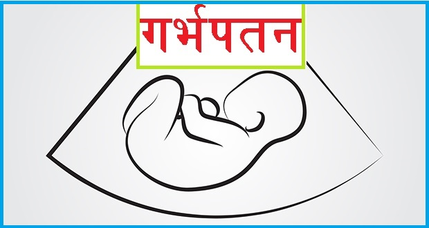 ujyaalo's tweet photo. असुरक्षित गर्भपतनबाट दैनिक औसत २ जना महिलाले ज्यान गुमाउँदै https://t.co/URejmcetTY https://t.co/pjcRVXS937