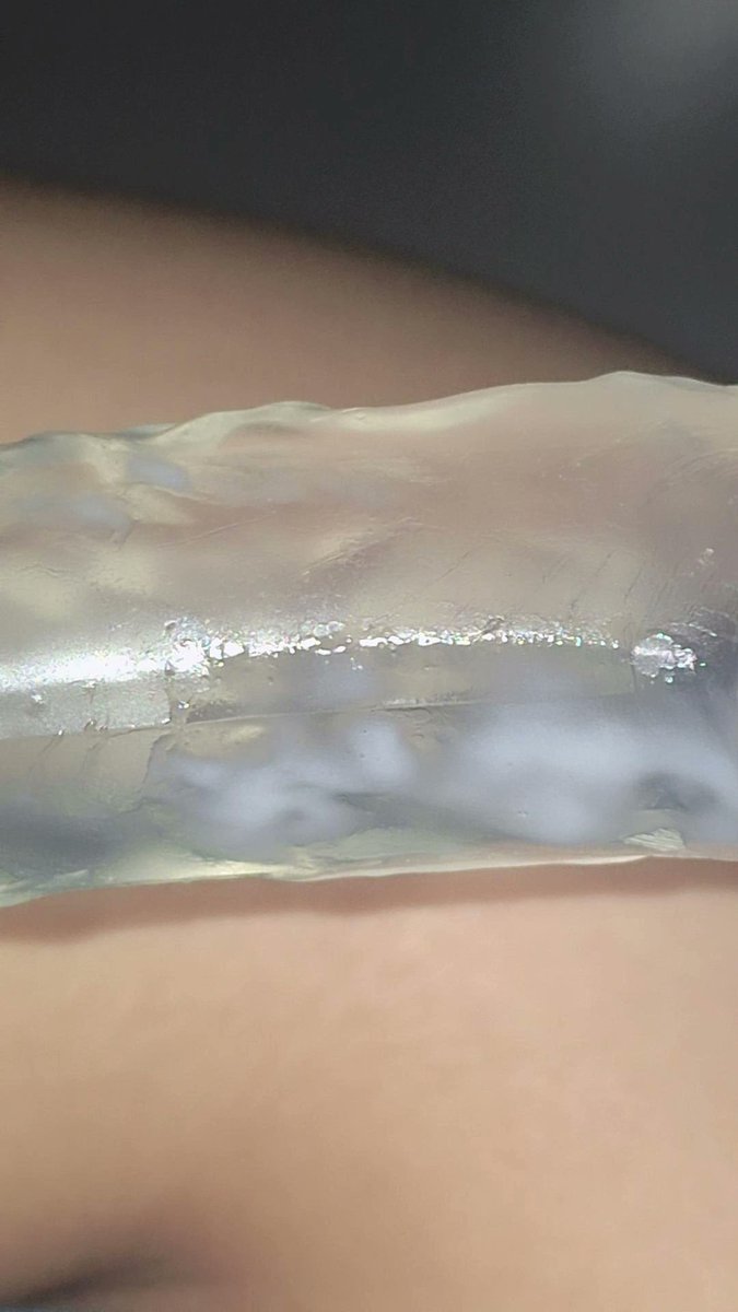 Cơ địa dễ lứng tweet media