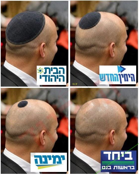 הפרגוד: התהליך של בנט