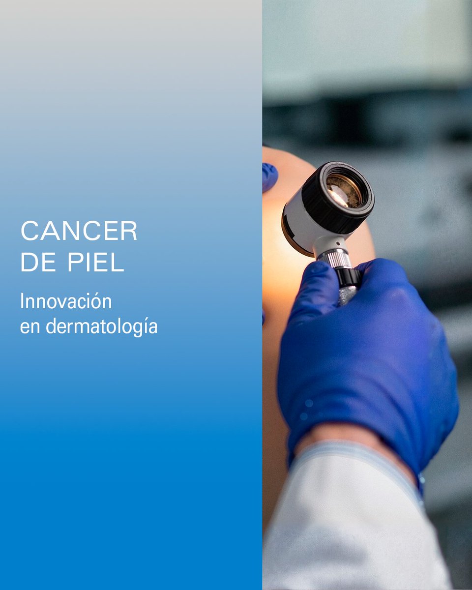 MDAnderson_ES's tweet photo. El arsenal terapéutico para el cáncer de piel ha experimentado una revolución en la última década, especialmente en los tumores avanzados. ​

La cirugía micrográfica de Mohs es una de las técnicas quirúrgicas más eficaces y seguras para extirpar el cáncer de piel. Se trata de una técnica de control de márgenes en tiempo real, indicada en carcinoma basocelular y carcinoma espinocelular de alto riesgo en localizaciones críticas (periorificial) o recurrentes. ​

Este tipo de cirugía permite las mayores tasas de curación con mínima pérdida de tejido sano:​

 ✔️ Elimina el tumor por capas​
 ✔️ Análisis inmediato​
 ✔️ Preservación al máximo el tejido sano​
​
#Dermatología #CáncerDePiel #UnidadMultidisciplinarPielyMelanoma