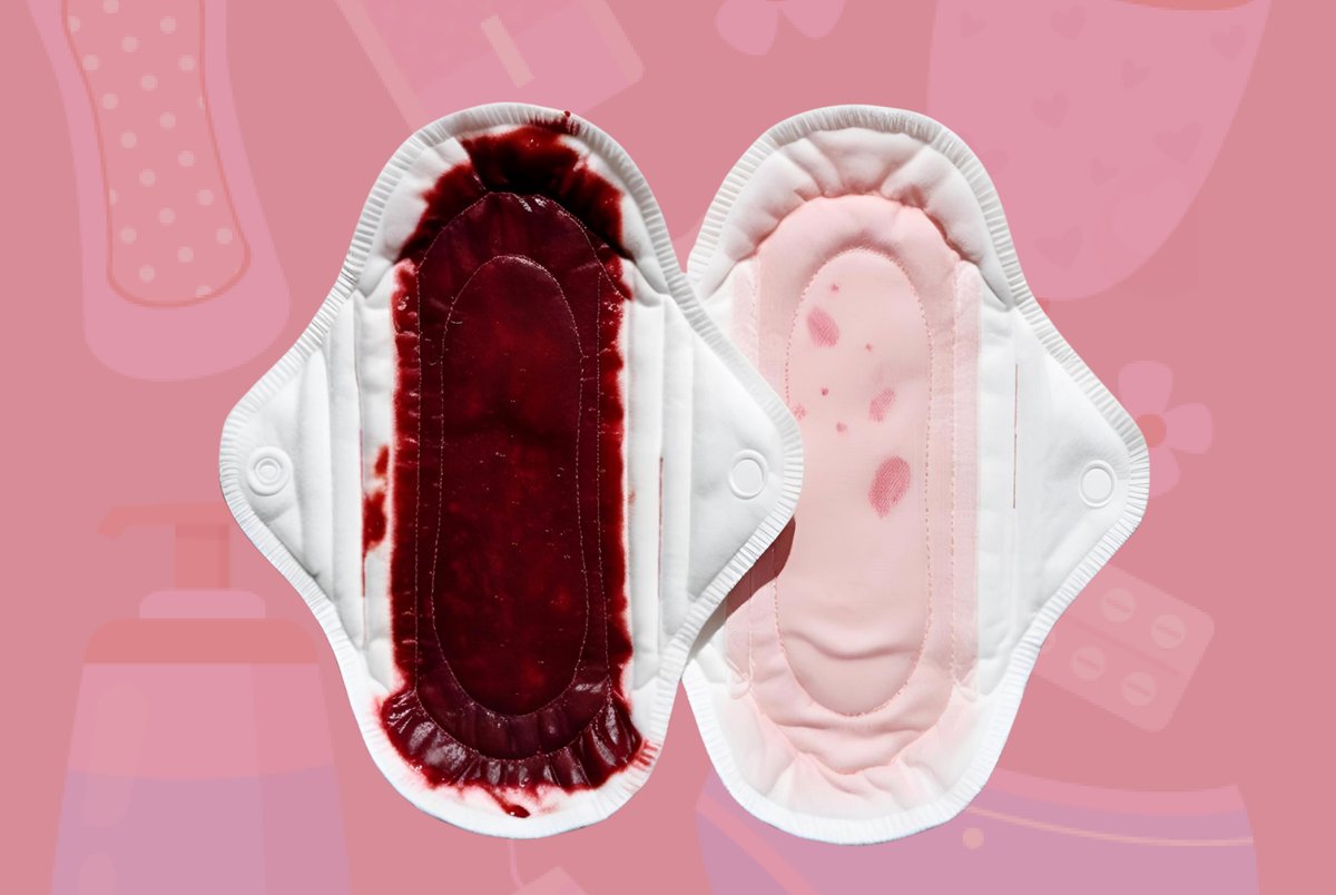 CycleKits's tweet photo. https://t.co/tvGiHbQ2ct

Menstruation is a natural part of the reproductive cycle in individuals with a uterus; however, the volume of menstrual flow can vary significantly.

Download the cyclekits app and take charge of your health today. #womenshealth https://t.co/A25w3eF9zA