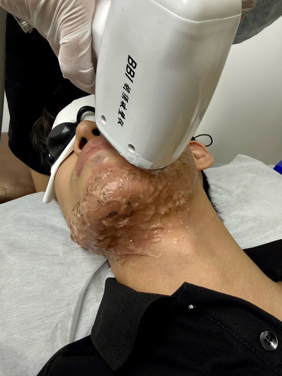 zhngy223495's tweet image. 藏在胡须里的秘密武器。清爽、干净、有型，这是给现代绅士的进阶方案💎。
The secret weapon in your grooming routine. Clean, sharp, and confident. Elevate your daily ritual.🧔🏻
​#GentlemanStyle #SelfCare #DailyRoutine #BeardGrooming