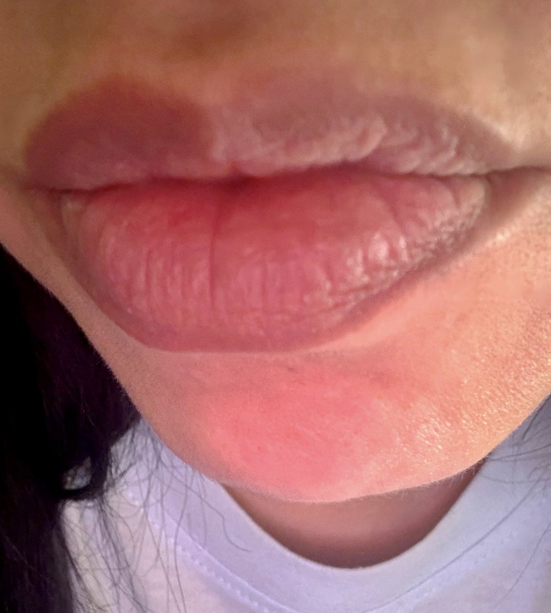 BlessedInCali's tweet photo. Lips 💋...without and with, lipgloss 😊 https://t.co/KoLWUjv4P9