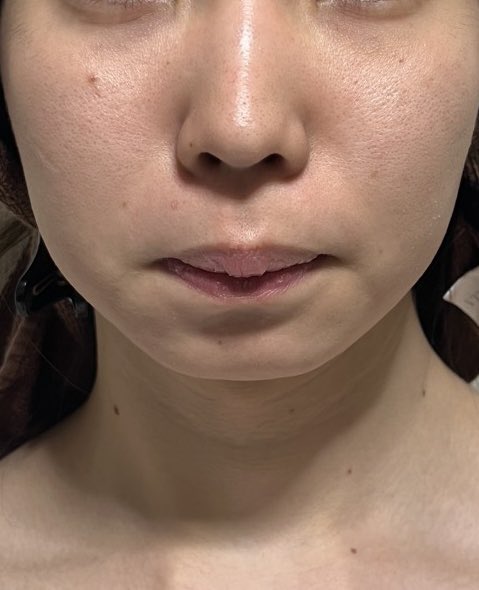 女装が働く清潔感メンテサロン ミモゼピア tweet media