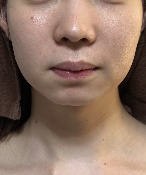 女装が働く清潔感メンテサロン ミモゼピア tweet media