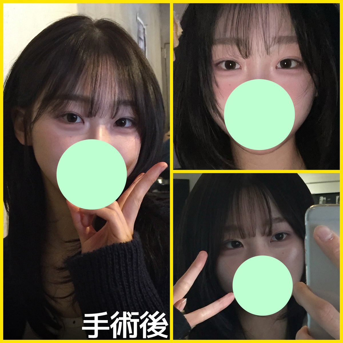バナナ美容整形外科🍌 tweet media