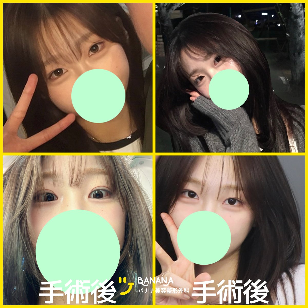 バナナ美容整形外科🍌 tweet media