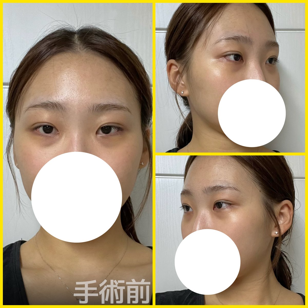 バナナ美容整形外科🍌 tweet media