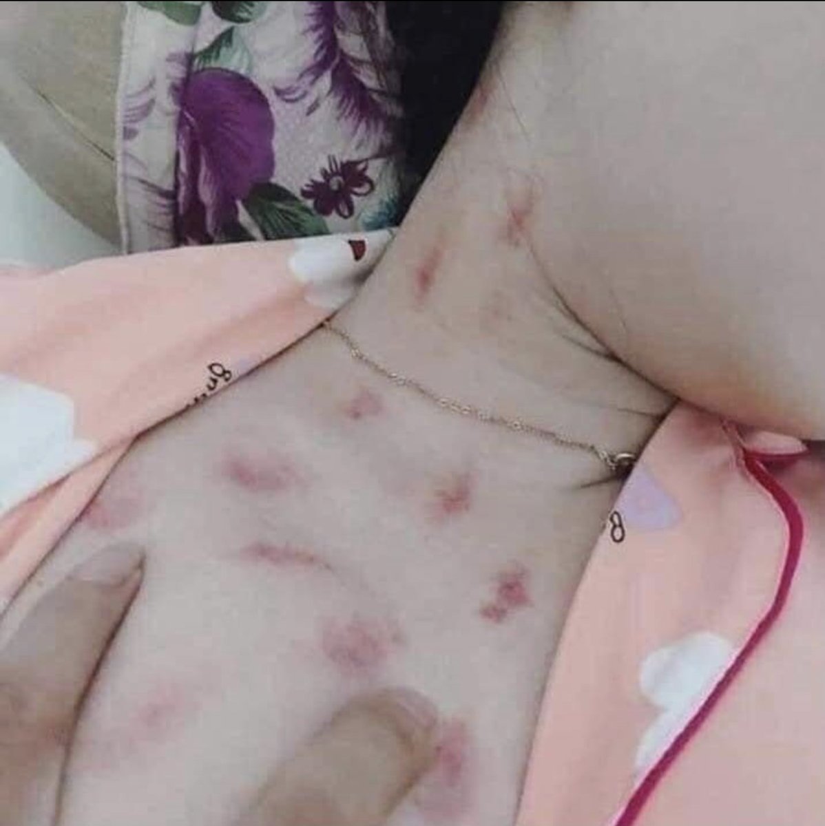 Ir. IPGSPR tweet media