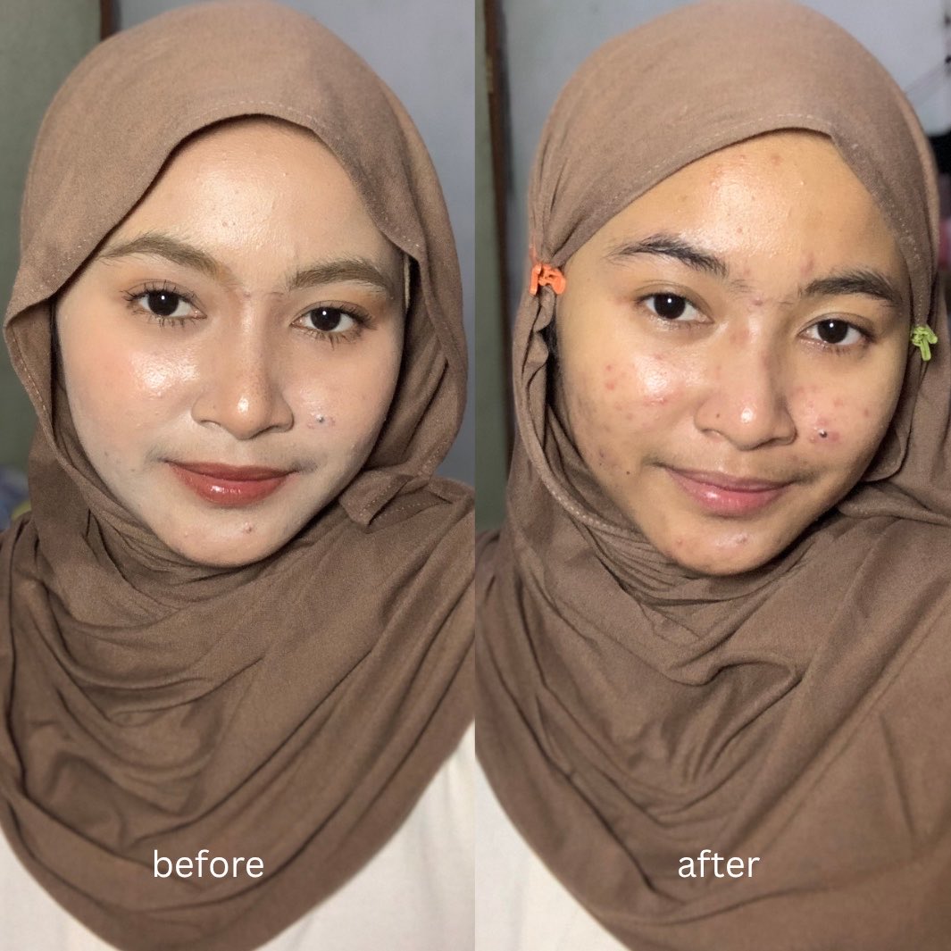 Lyn 👒 tweet media