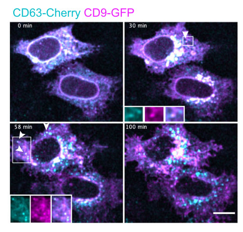 CD Bioparticles provides a variety of viral vectors that can be directly used to infect parental cells, enabling efficient and reliable tracking of exosome dynamics. 
cd-bioparticles.net/services/virus…