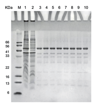 CD Bioparticles offers a broad range of magnetic agarose particles for efficient and repeatable protein/antibody purification. 
cd-bioparticles.com/flyer/pdf/com/…