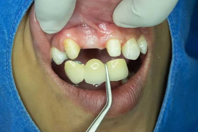 dentyoudare's tweet photo. @andihiyat pengn pasieeen yukk dm https://t.co/aHDILzSUIl