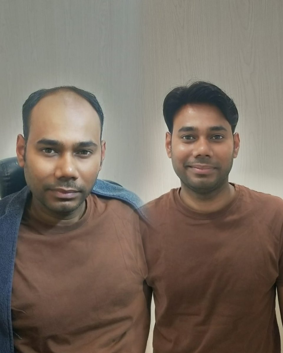 masakihairpatch's tweet image. What is the life of a hair patch? | Hair Patch Service in Delhi Kalkaji
The life of a hair patch depends on the person who uses it, how they use it and how much care they take in it. For more details Visit our website:- masaki.in
#hairpatch #haircare #hairstyle