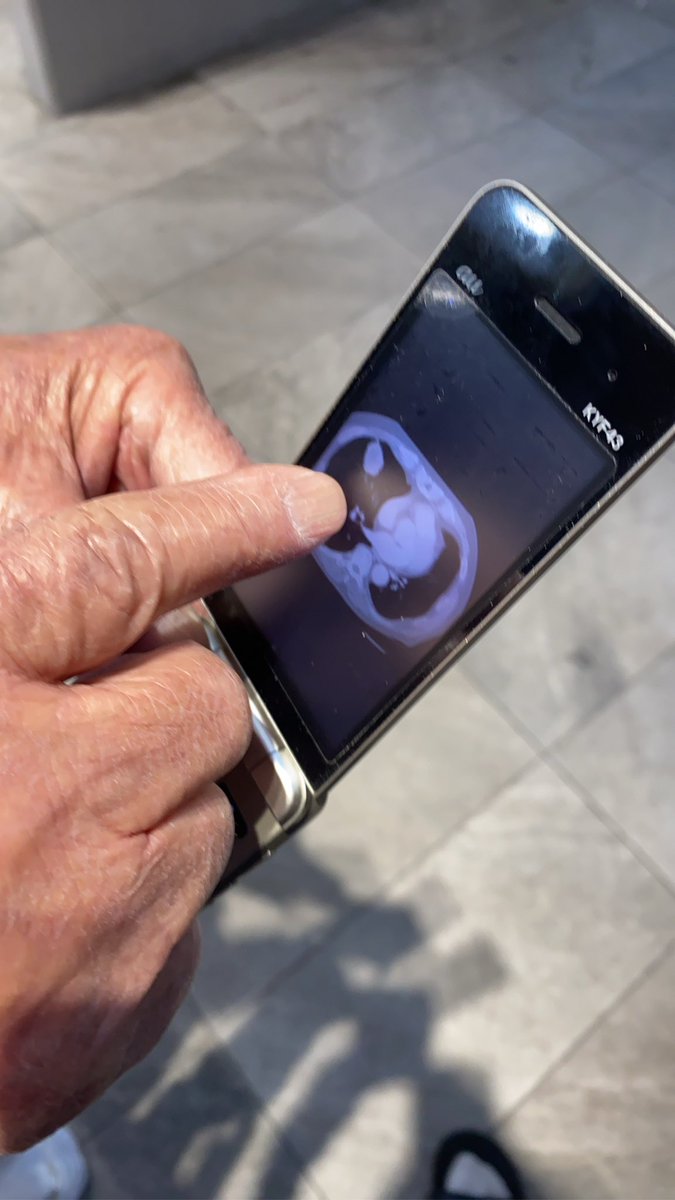 エビフライ君 tweet media