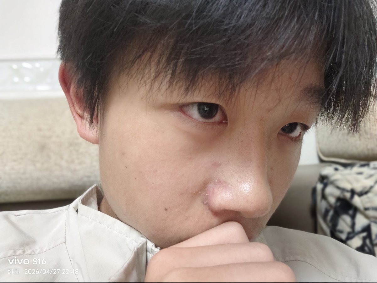 feimo6586's tweet photo. 最近皮肤状态好差😭😭😭 https://t.co/tNRB9Wdi5d