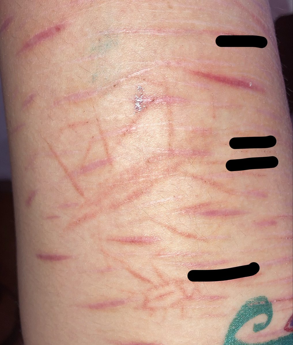 Juno_Cvts's tweet image. Look at my beautiful  MAKEUP #Fake #SFX #makeup
The butterfly and bug is fading 
Bby beans scar :3