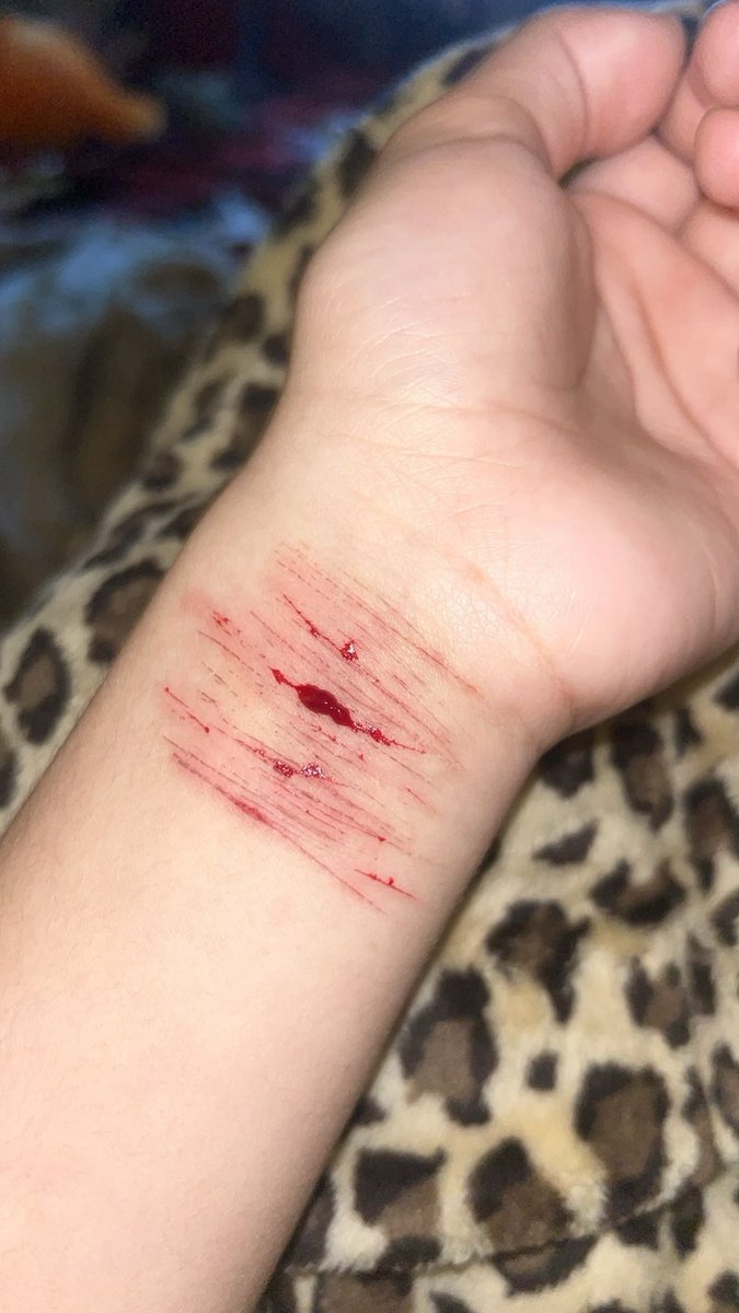 scarrrfac3's tweet photo. i wish i could cut deeper #sh #cutting #blood https://t.co/cGdURoqiIk